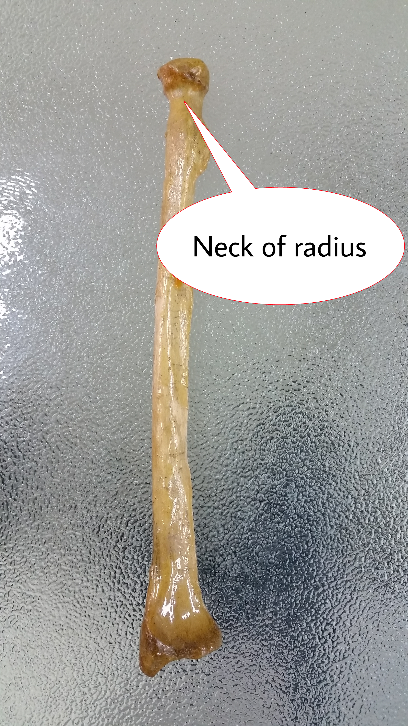 گردن رادیوس اطلس الکترونیک آناتومی